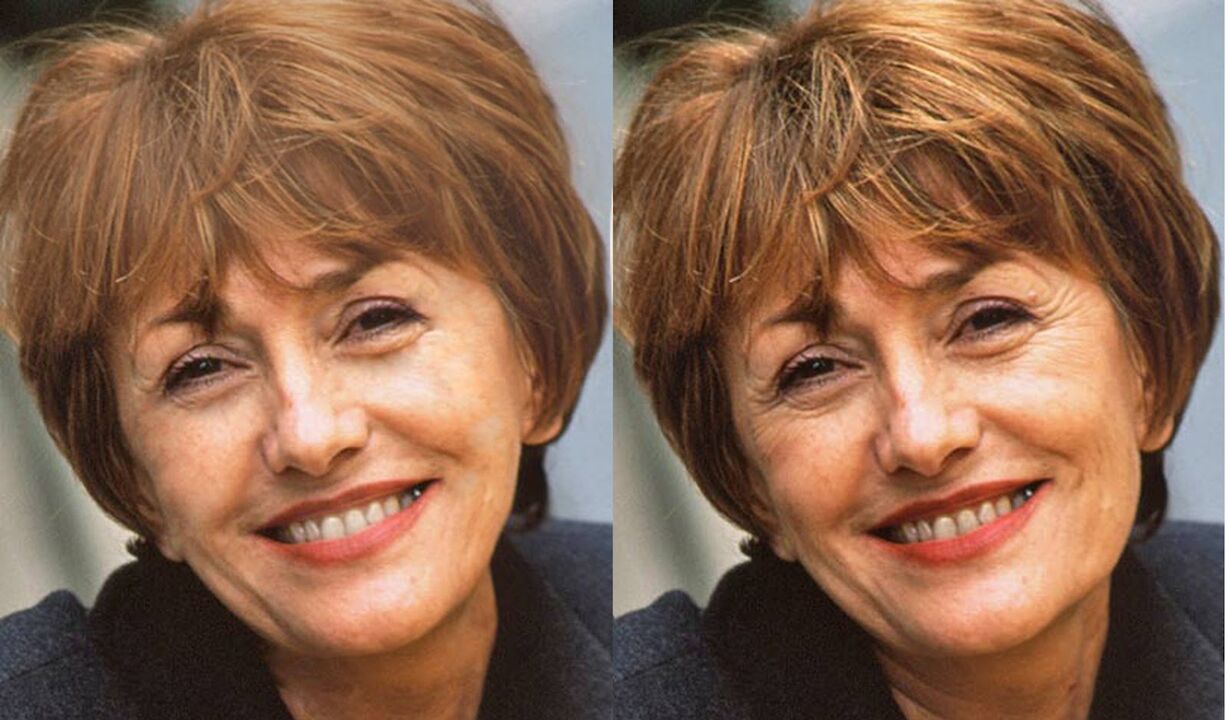 foto de la cara antes y después del contorno